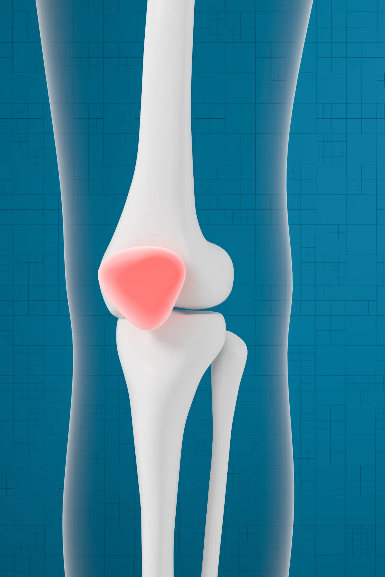 Joint Disorder | Conditions | iMsk & Spine Group | Long Island & Queens NY