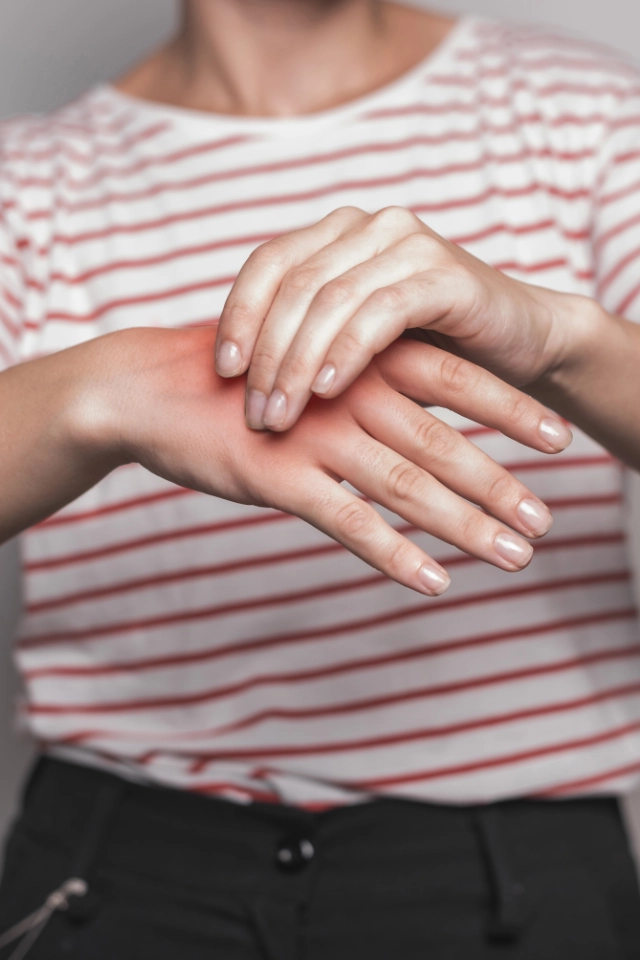 Condition Carpal Tunnel Syndrom Img 1 Hicksville