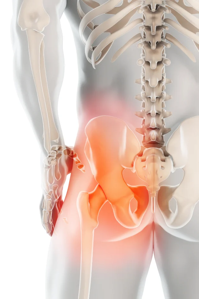 Condition Hip Joint Disorders Freeport