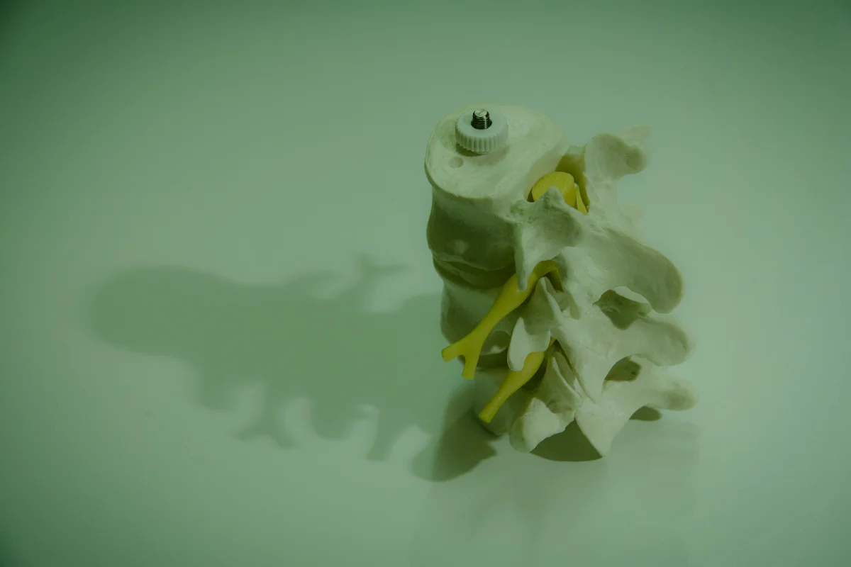 Condition Joint Disorder Img 1 Imsk Spine