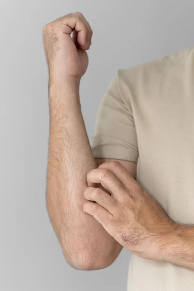 Condition Post Herpetic Neuralgia Img 1 Hicksville