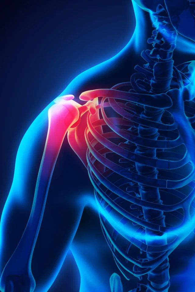 Condition Rotator Cuff Injuries Img 1 Far Rockaway