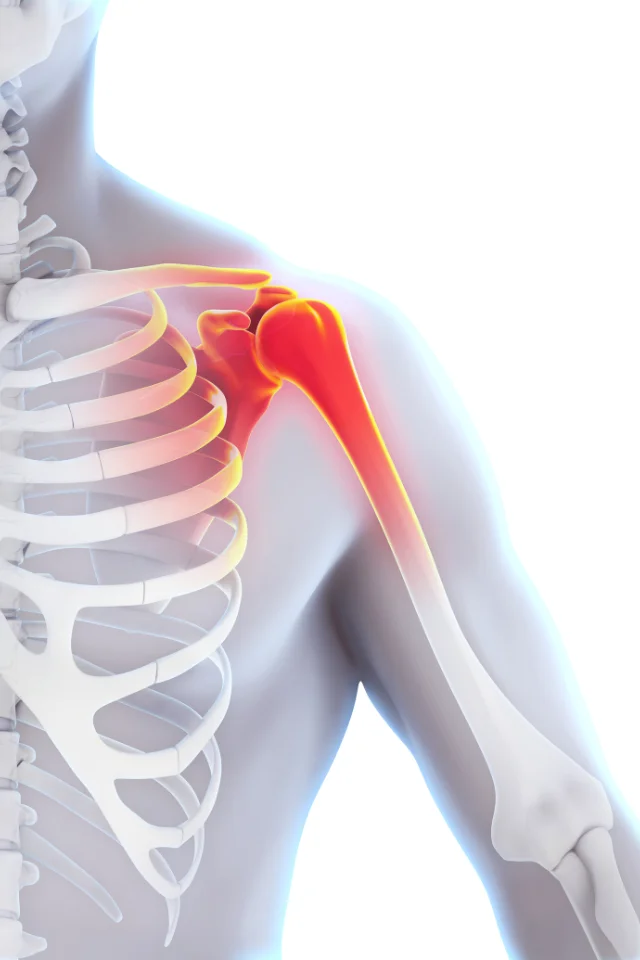 Condition Rotator Cuff Injuries Img 2 Freeport