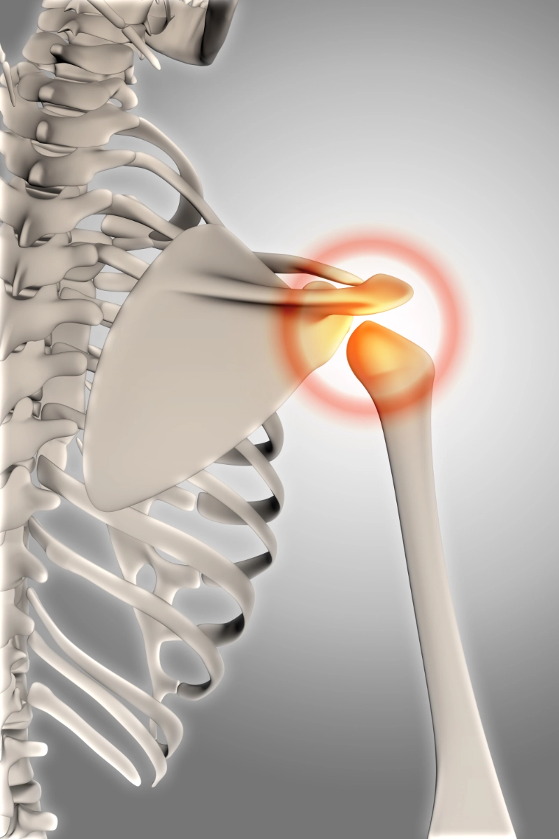 Condition Shoulder Joint Disorders Img 1
