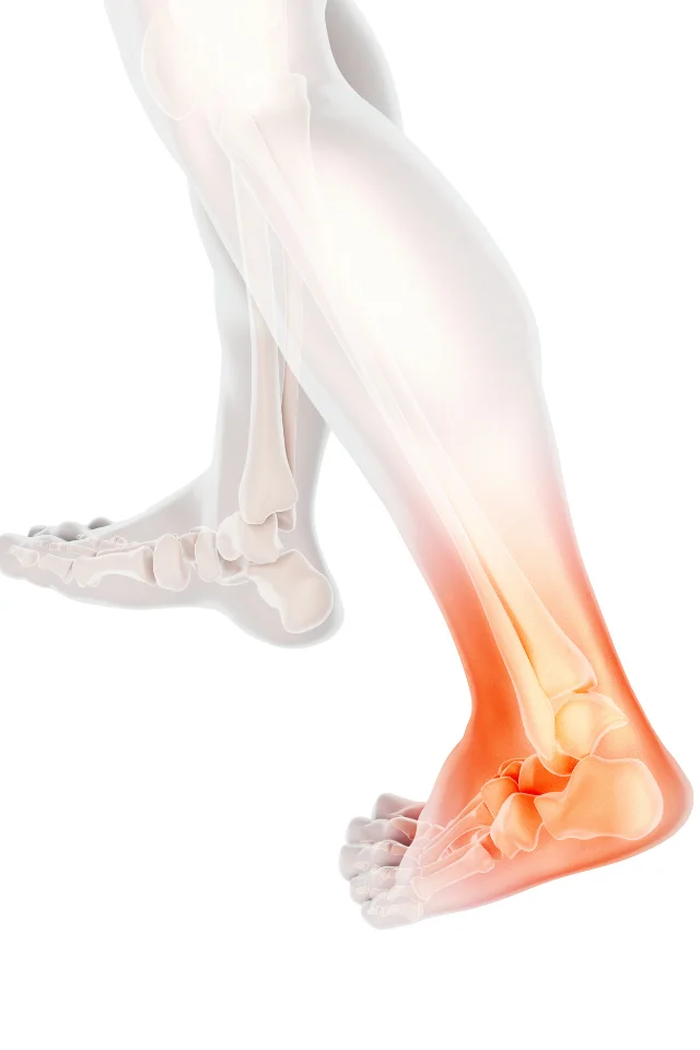 Condition Tarsal Tunnel Syndrome Img 2 Far Rockaway