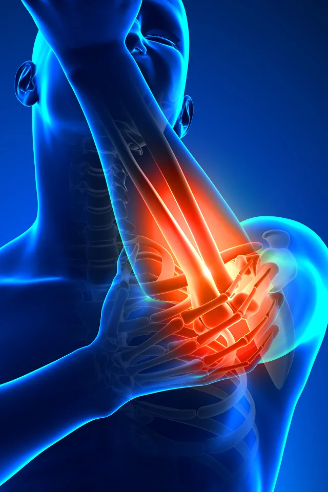 Condition Tennis Elbow Img 2 Far Rockaway