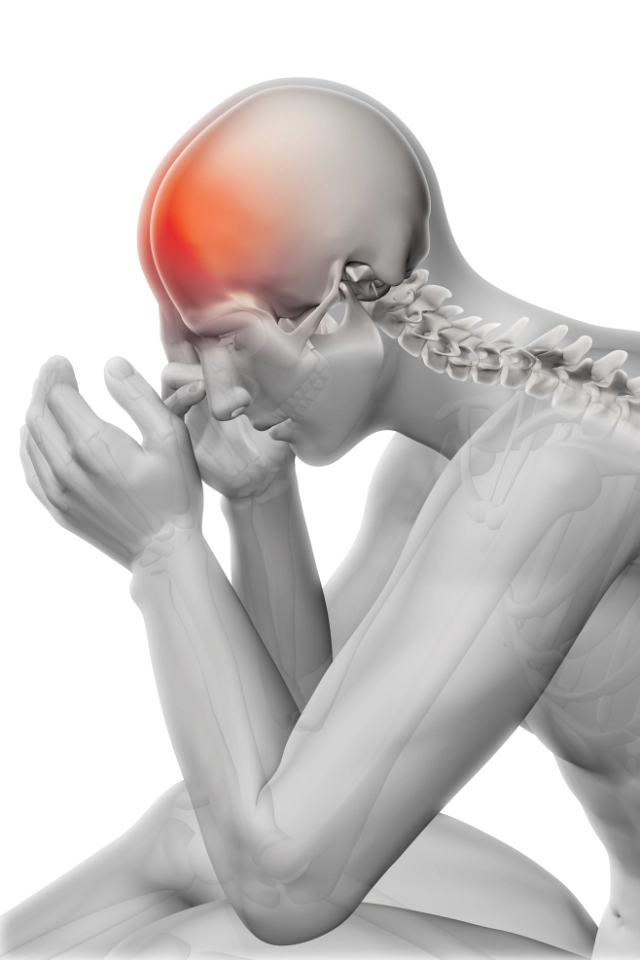 Pain Management Botox For Migraine Img 2 Far Rockaway